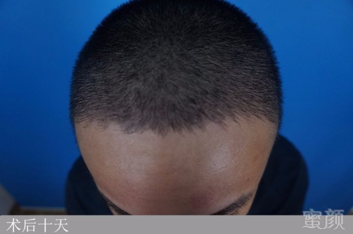 https://img.miyanlife.com/mnt/timg/171019/11233LN8-2.jpg