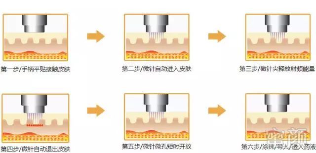 案例图片