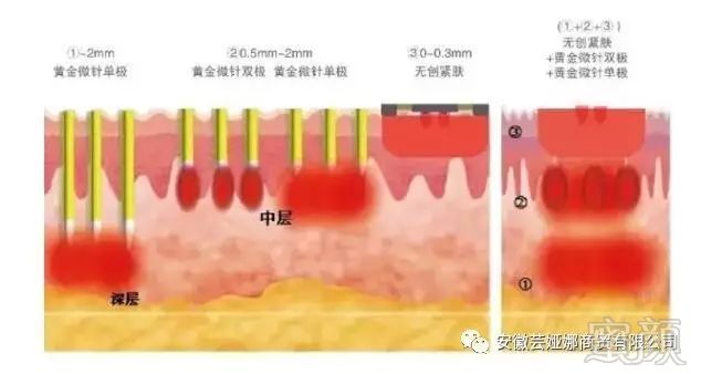 案例图片