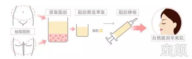 https://img.miyanlife.com/mnt/timg/171019/1223124P9-7.jpg