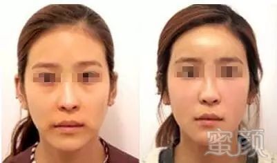 https://img.miyanlife.com/mnt/timg/171019/1223134T9-9.jpg
