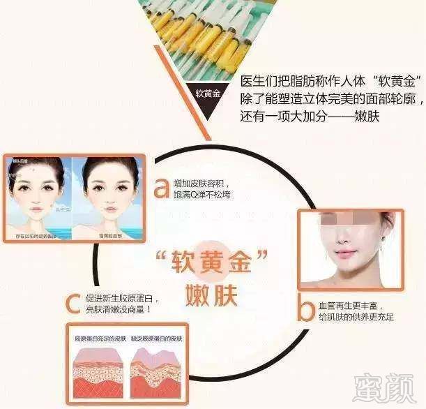 https://img.miyanlife.com/mnt/timg/171019/13131W162-6.jpg