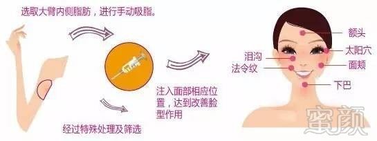 https://img.miyanlife.com/mnt/timg/171020/125Q41Z6-3.jpg