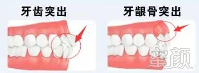 案例图片