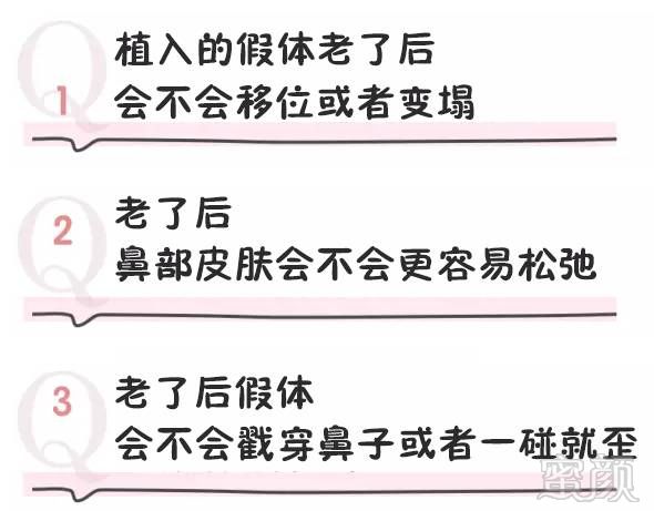 https://img.miyanlife.com/mnt/timg/171021/1155005E7-4.jpg