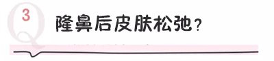 https://img.miyanlife.com/mnt/timg/171021/115502B64-9.jpg