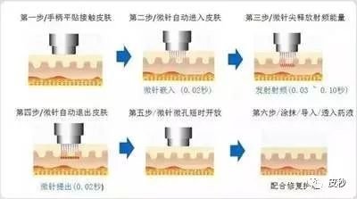 案例图片