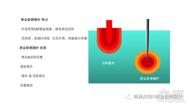 案例图片