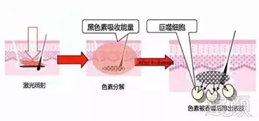 案例图片