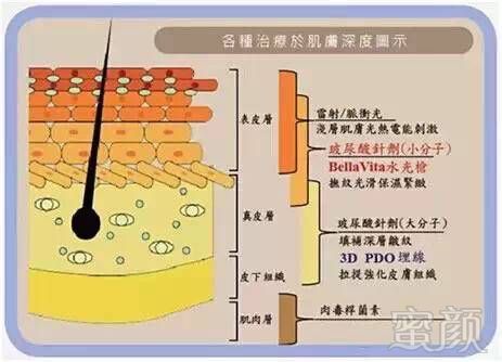 案例图片