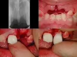 https://img.miyanlife.com/mnt/timg/171024/10060LC5-4.jpg