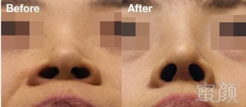 https://img.miyanlife.com/mnt/timg/171024/113G04091-12.jpg