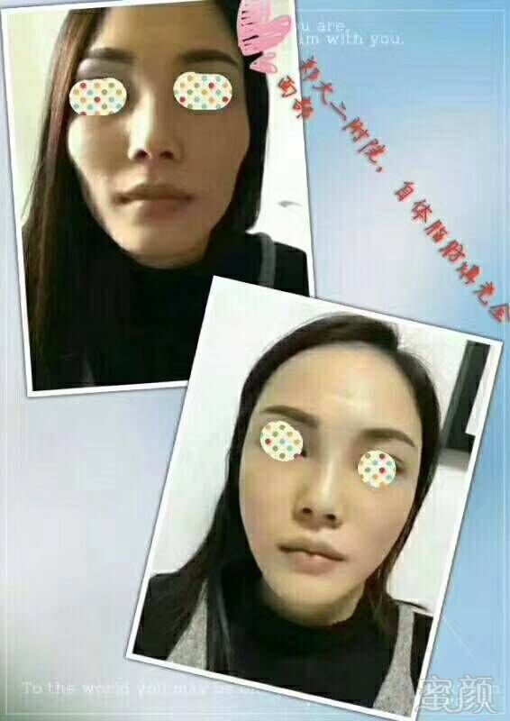 https://img.miyanlife.com/mnt/timg/171025/103G463H-5.jpg