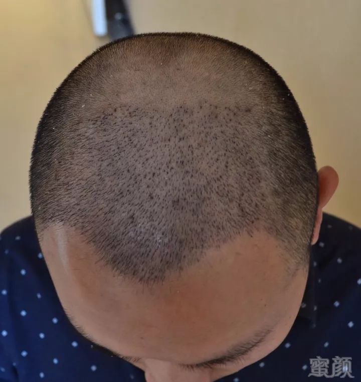 https://img.miyanlife.com/mnt/timg/171025/112045D28-10.jpg