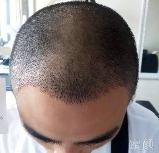 https://img.miyanlife.com/mnt/timg/171025/11204C308-14.jpg