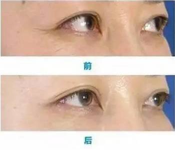 https://img.miyanlife.com/mnt/timg/171025/113134LR-9.jpg