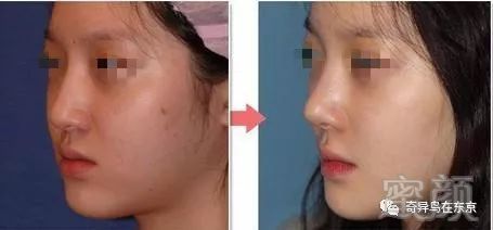 https://img.miyanlife.com/mnt/timg/171025/12204442G-0.jpg