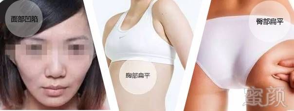 https://img.miyanlife.com/mnt/timg/171025/1221433646-1.jpg