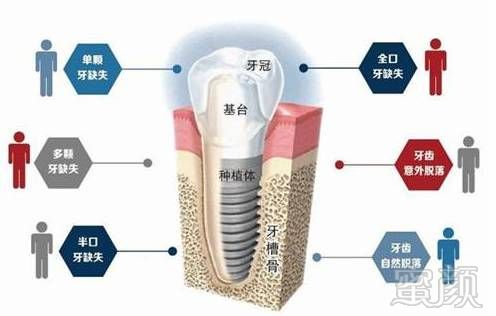 https://img.miyanlife.com/mnt/timg/171025/122IS960-6.jpg