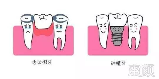 https://img.miyanlife.com/mnt/timg/171025/122PBP3-2.jpg