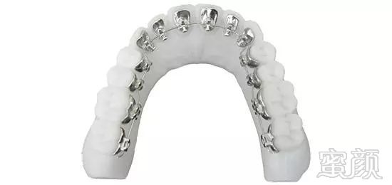 https://img.miyanlife.com/mnt/timg/171025/12444Q945-3.jpg