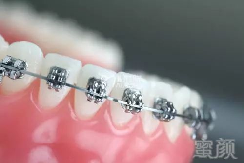https://img.miyanlife.com/mnt/timg/171025/12444T458-0.jpg