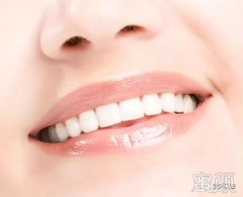 https://img.miyanlife.com/mnt/timg/171025/12450IN5-0.jpg