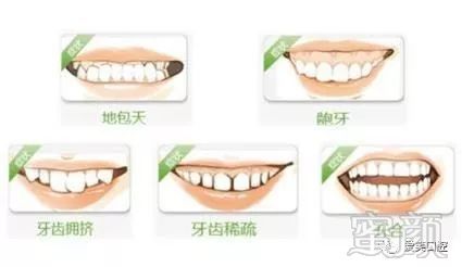 https://img.miyanlife.com/mnt/timg/171025/12450Q613-3.jpg