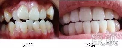 https://img.miyanlife.com/mnt/timg/171025/12450S943-5.jpg
