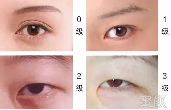https://img.miyanlife.com/mnt/timg/171025/12505a446-3.jpg