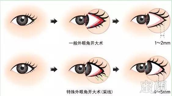 https://img.miyanlife.com/mnt/timg/171025/12505a505-6.jpg