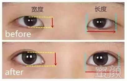 https://img.miyanlife.com/mnt/timg/171025/125P43392-1.jpg