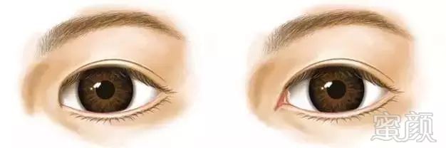 https://img.miyanlife.com/mnt/timg/171025/125P53039-5.jpg