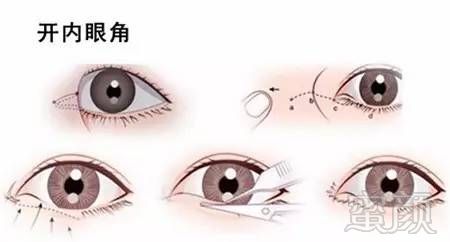 https://img.miyanlife.com/mnt/timg/171025/125P63106-7.jpg