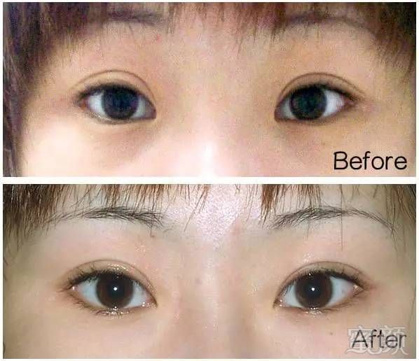 https://img.miyanlife.com/mnt/timg/171025/125PHW6-10.jpg