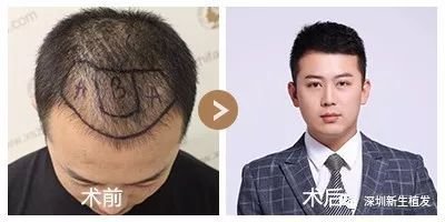 https://img.miyanlife.com/mnt/timg/171025/1323091J3-3.jpg