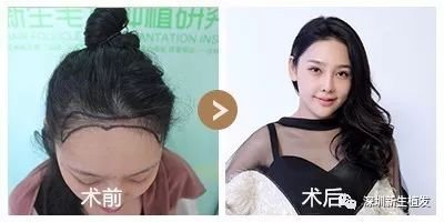 https://img.miyanlife.com/mnt/timg/171025/1323095155-2.jpg