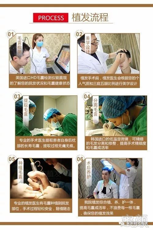 https://img.miyanlife.com/mnt/timg/171025/13230L335-0.jpg
