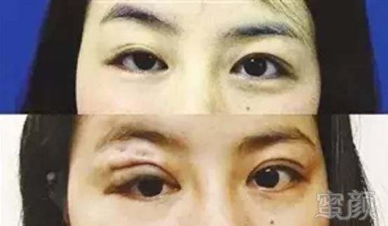 https://img.miyanlife.com/mnt/timg/171025/13313R624-2.jpg