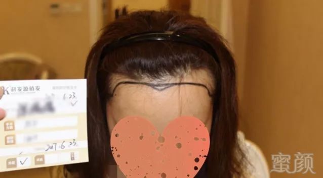 https://img.miyanlife.com/mnt/timg/171026/1116191405-0.jpg