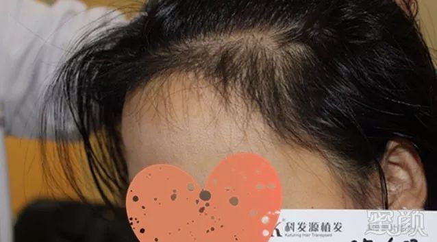 https://img.miyanlife.com/mnt/timg/171026/1116215923-9.jpg