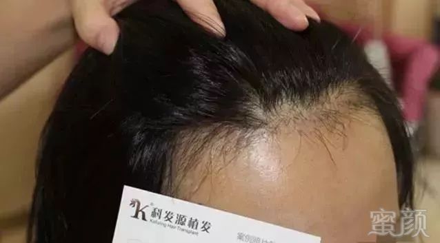 https://img.miyanlife.com/mnt/timg/171026/111621H31-6.jpg