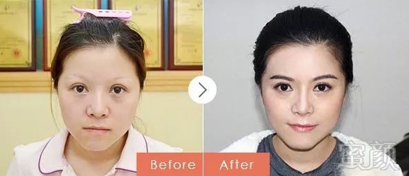 https://img.miyanlife.com/mnt/timg/171026/11162212R-11.jpg
