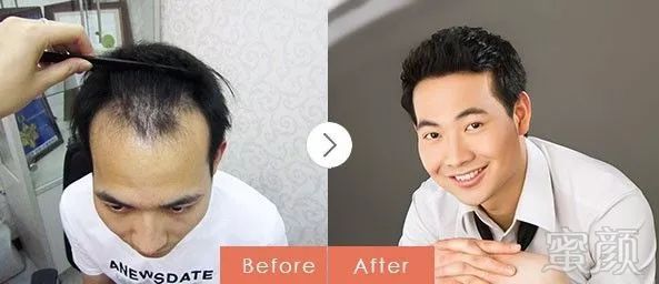 https://img.miyanlife.com/mnt/timg/171026/11162262B-12.jpg