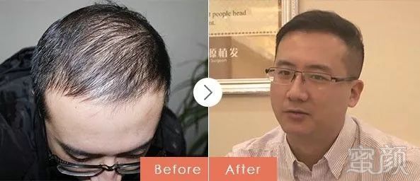 https://img.miyanlife.com/mnt/timg/171026/111622L35-13.jpg