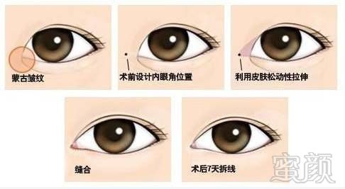 https://img.miyanlife.com/mnt/timg/171026/113635N22-7.jpg