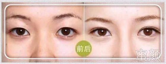https://img.miyanlife.com/mnt/timg/171026/1136363496-14.jpg