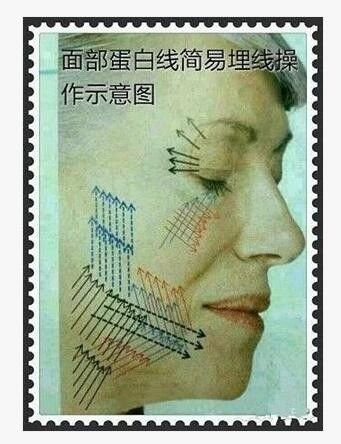 案例图片