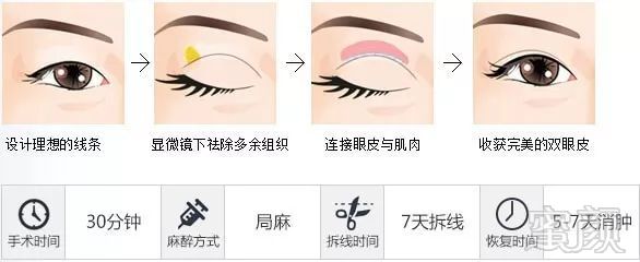 https://img.miyanlife.com/mnt/timg/171026/133J254M-1.jpg