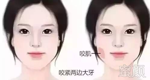 https://img.miyanlife.com/mnt/timg/171026/13435B3L-8.jpg